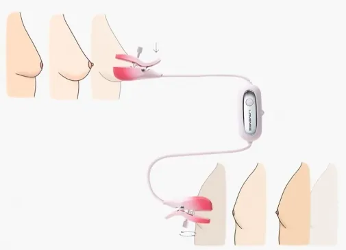 LOVENSE Gemini 可用手機App控制 乳頭夾
